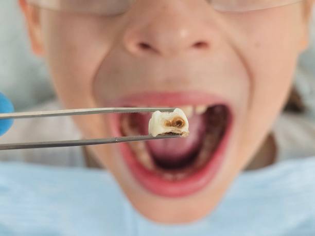 Best Same-Day Emergency Dental Services in Goodwell, OK